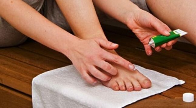 tratamentul ciupercii unghiilor de la picioare cu unguent